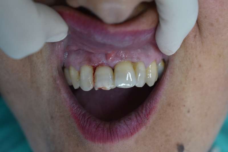 inicial