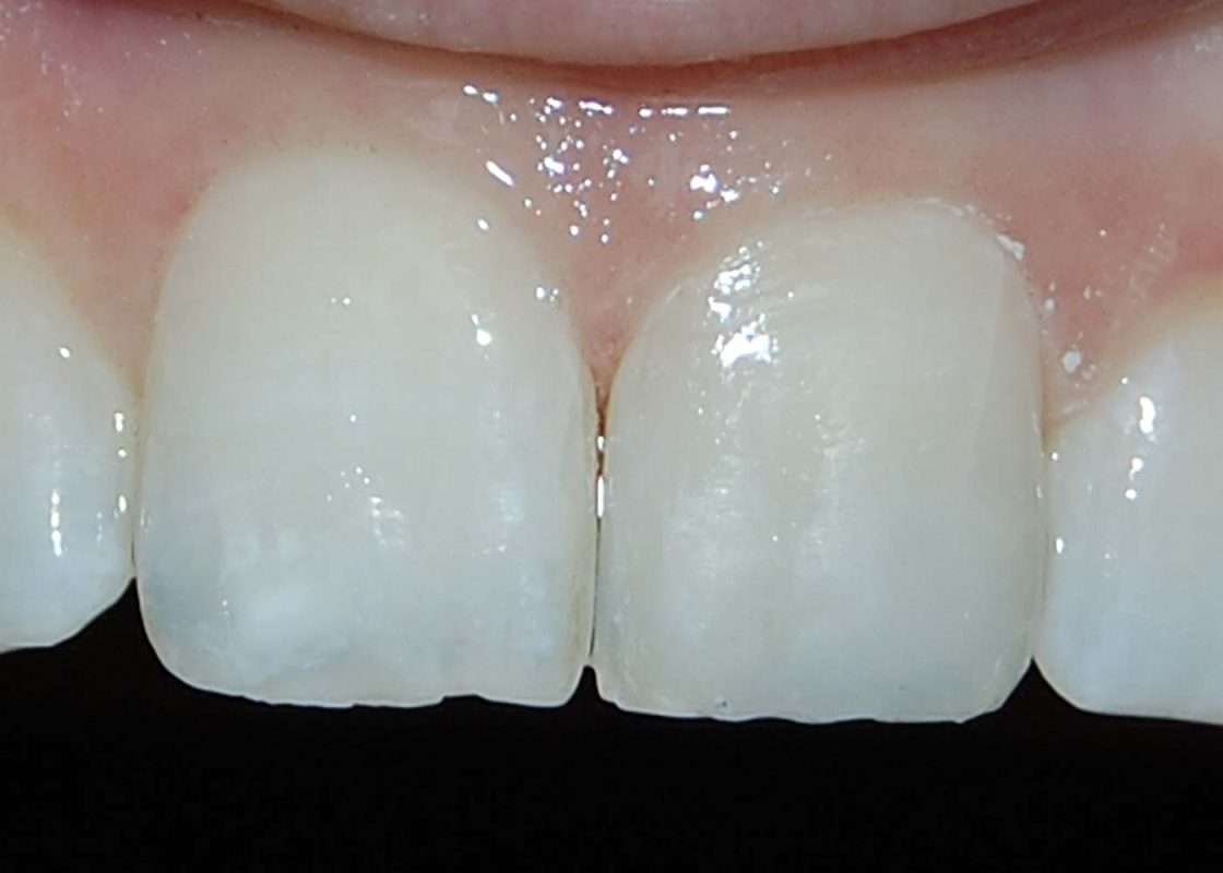 composite 01 final
