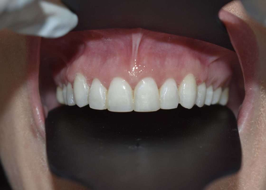 composite 03 final