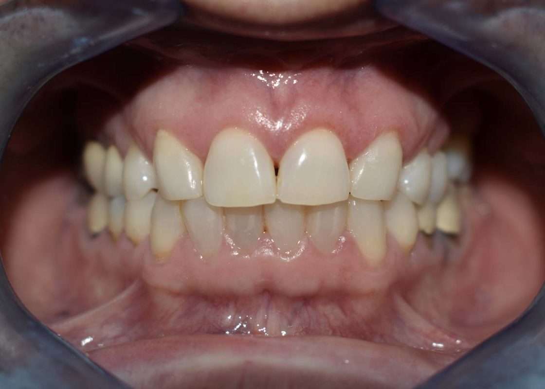 composite 05 final