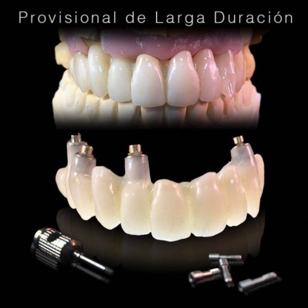implante clinica naval5