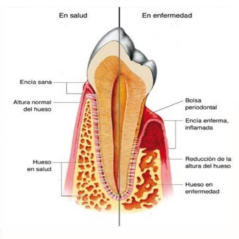 la periodoncia