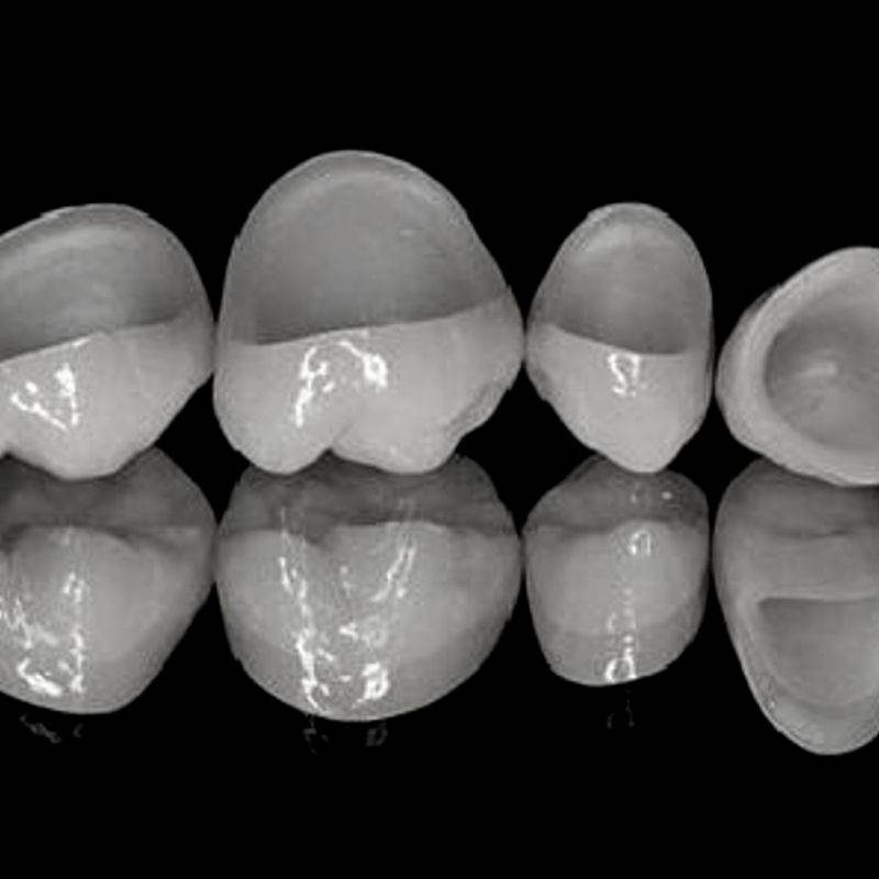 protesis clinica naval2
